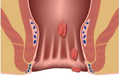 img-service06 img-service06