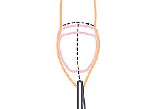 img-service10 img-service10